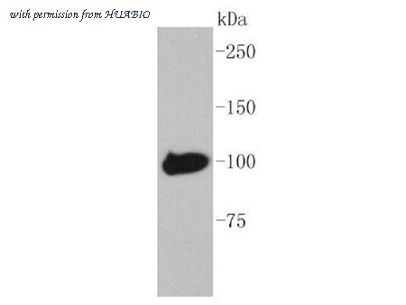 HUABIO ET1602-46 image 1