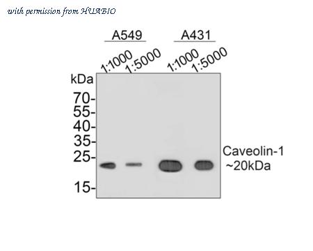 HUABIO ET1603-1 image 1