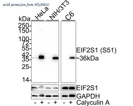 HUABIO ET1603-14-50UL image 1