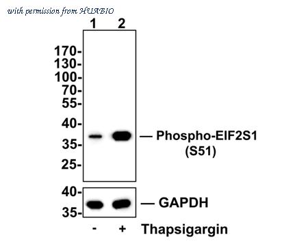 HUABIO ET1603-14-50UL image 3