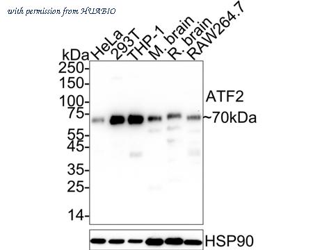 HUABIO ET1603-15 image 1