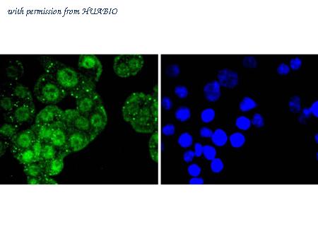 HUABIO ET1603-15 image 2