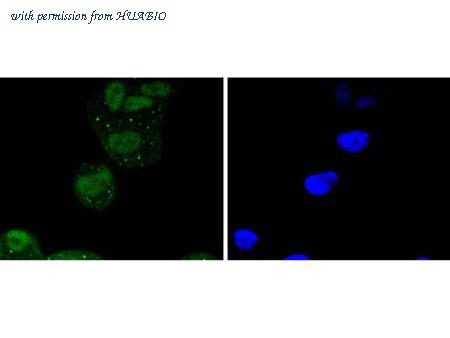 HUABIO ET1603-15 image 3