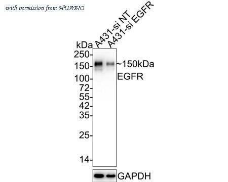 HUABIO ET1603-37 image 2