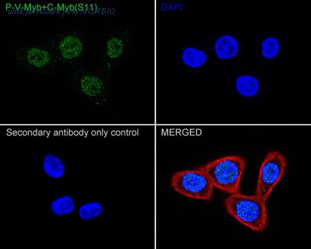 HUABIO ET1603-41 image 1