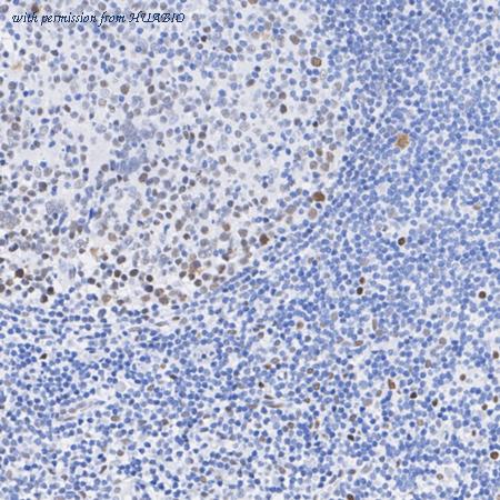 HUABIO ET1603-41 image 2