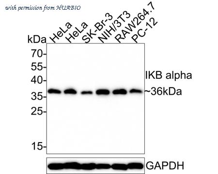HUABIO ET1603-6 image 1
