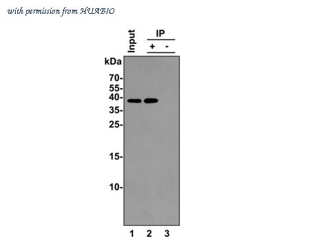 HUABIO ET1603-6 image 2