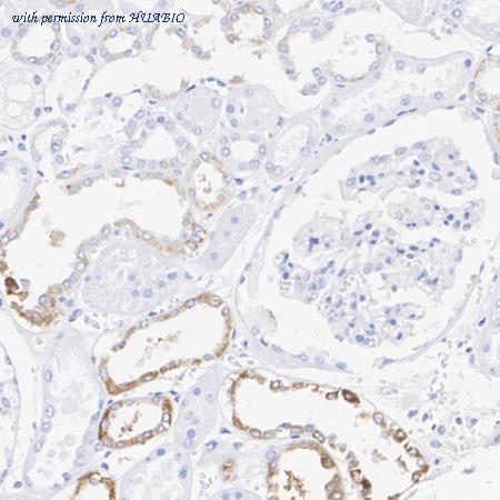 HUABIO ET1603-6 image 3