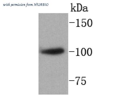 HUABIO ET1604-10 image 1