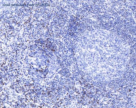 HUABIO ET1604-10 image 3