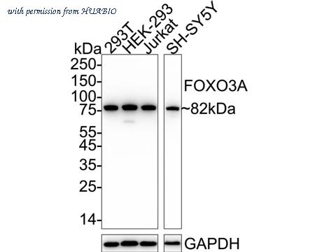 HUABIO ET1604-11 image 1
