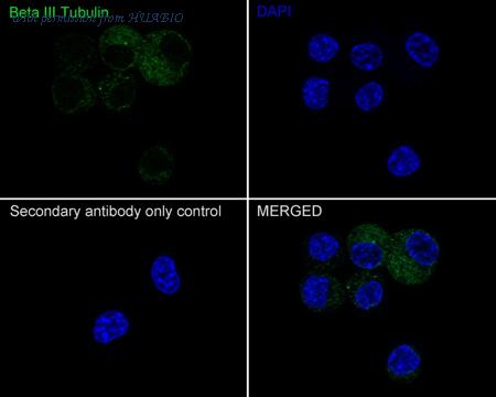 HUABIO ET1604-17 image 3
