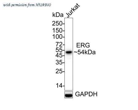HUABIO ET1604-21-50UL image 1