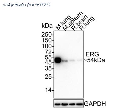 HUABIO ET1604-21-50UL image 2