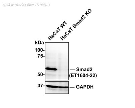 HUABIO ET1604-22 image 3