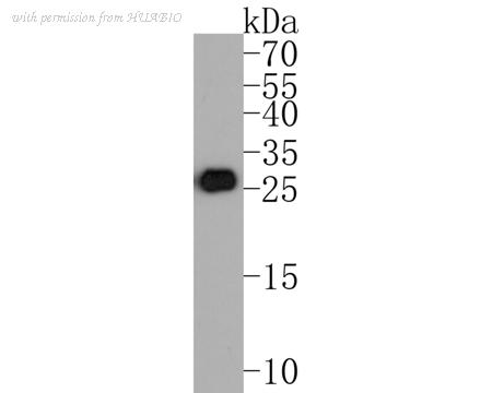 HUABIO ET1604-26 image 1
