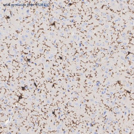 HUABIO ET1604-26 image 3