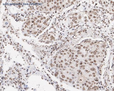 HUABIO ET1604-27 image 3