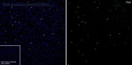 HUABIO ET1604-29 image 1