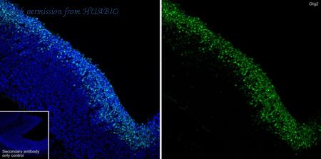 HUABIO ET1604-29 image 2