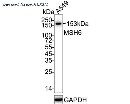 HUABIO ET1604-39 image 1