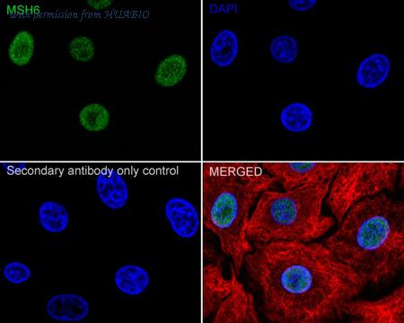 HUABIO ET1604-39 image 2