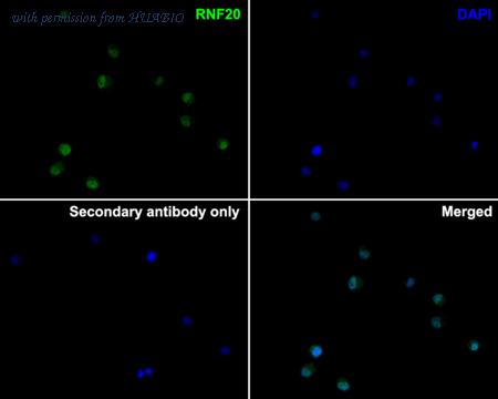 HUABIO ET1604-4 image 3