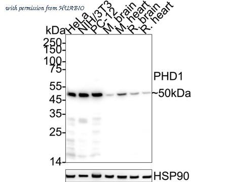 HUABIO ET1604-5 image 1