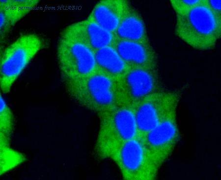 HUABIO ET1604-5 image 2