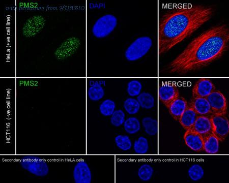 HUABIO ET1605-1 image 1