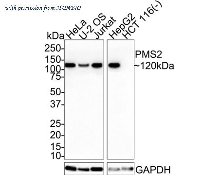 HUABIO ET1605-1 image 3