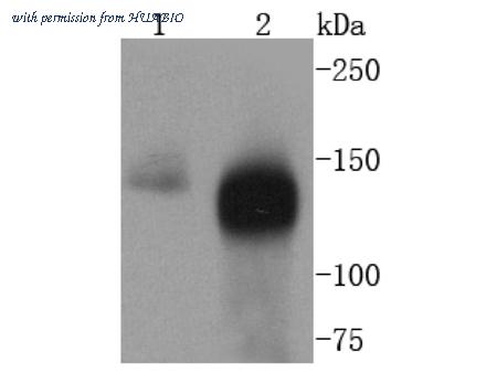 HUABIO ET1605-18 image 1