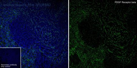 HUABIO ET1605-20 image 2