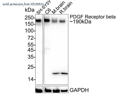 HUABIO ET1605-20 image 3