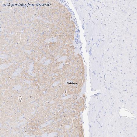 HUABIO ET1605-24 image 3