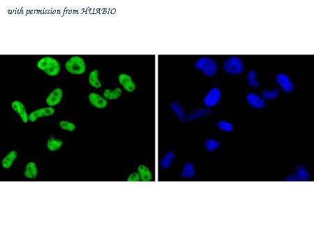 HUABIO ET1605-26 image 3