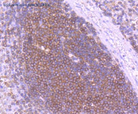 HUABIO ET1605-30 image 3