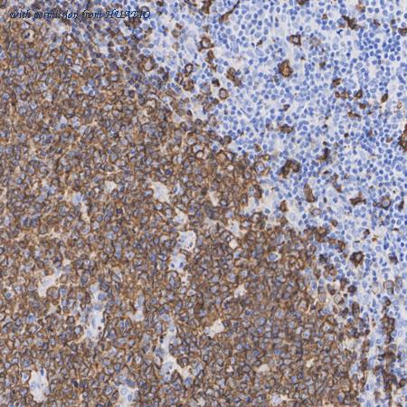 HUABIO ET1605-33 image 2