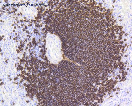 HUABIO ET1605-33 image 3