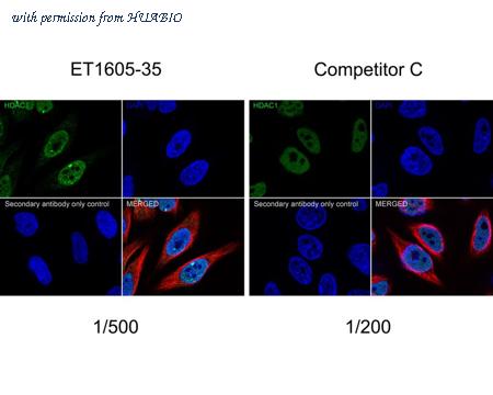 HUABIO ET1605-35 image 2