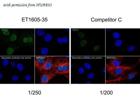 HUABIO ET1605-35 image 3