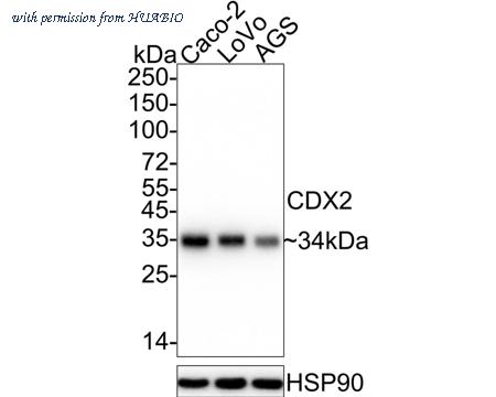 HUABIO ET1605-4 image 1