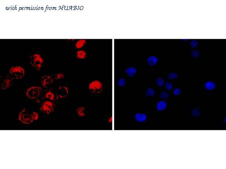 HUABIO ET1605-4 image 3