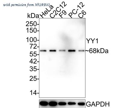HUABIO ET1605-40 image 1