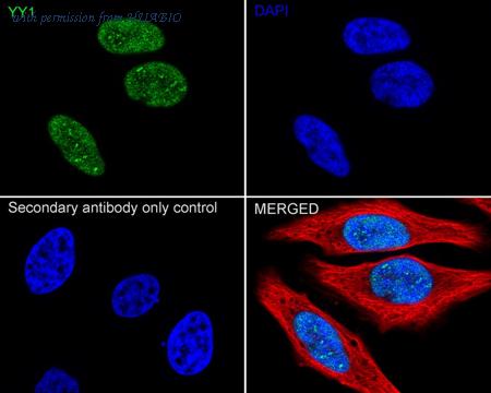 HUABIO ET1605-40 image 2