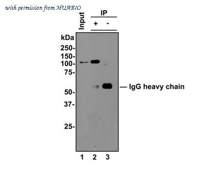 HUABIO ET1605-49 image 3