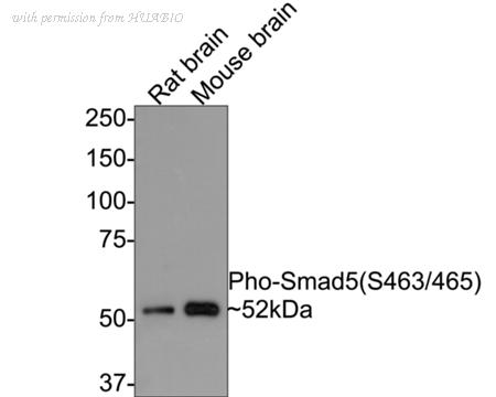 HUABIO ET1605-5 image 2