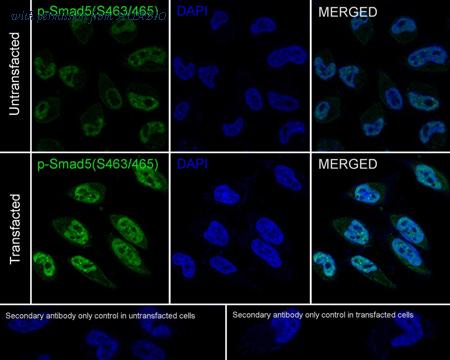 HUABIO ET1605-5 image 3
