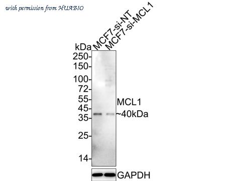 HUABIO ET1606-14 image 1